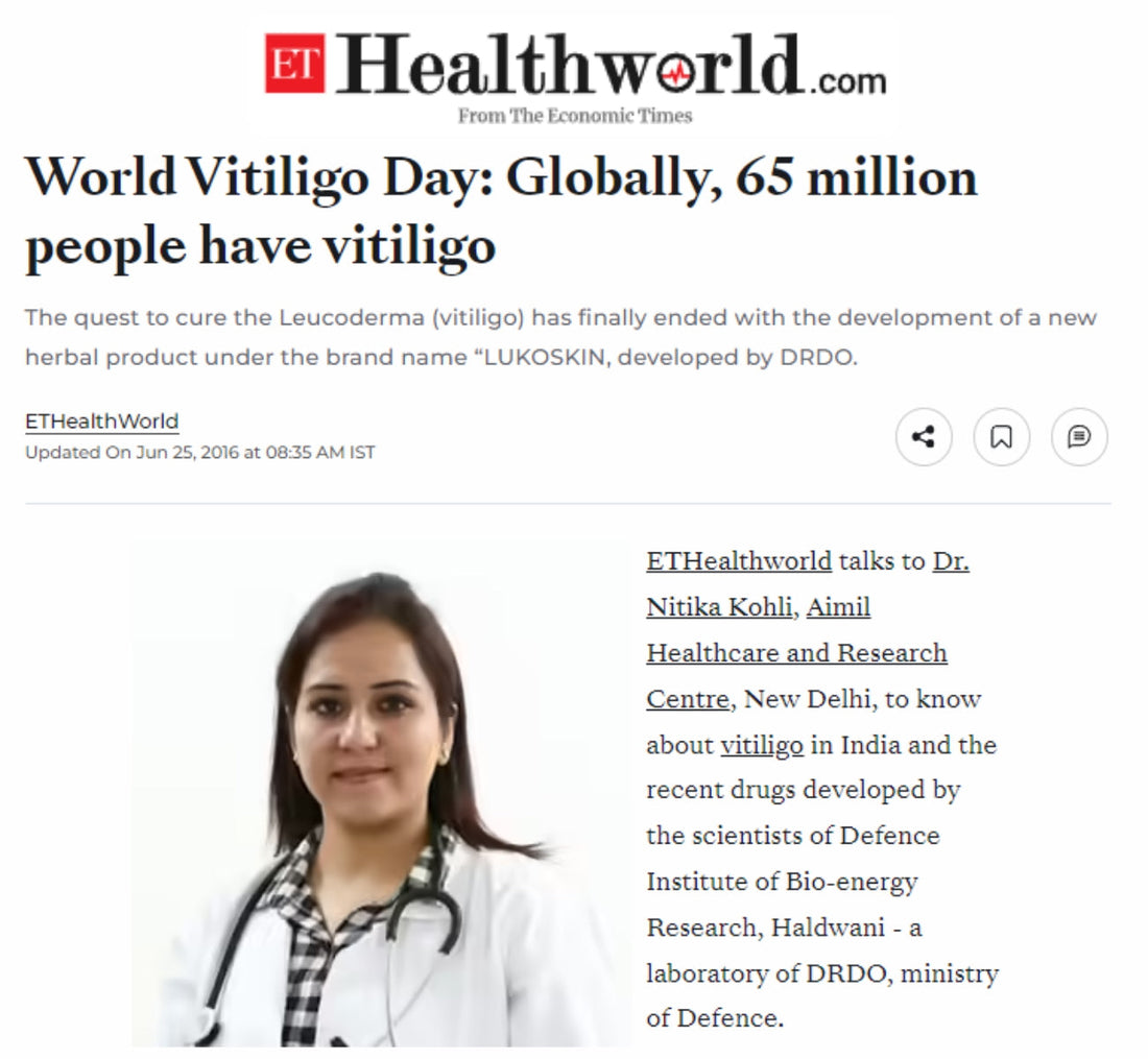 World Vitiligo Day: Globally, 65 million people have vitiligo