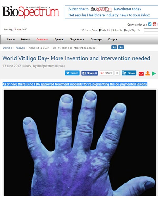 World Vitiligo Day- More Invention and Intervention needed